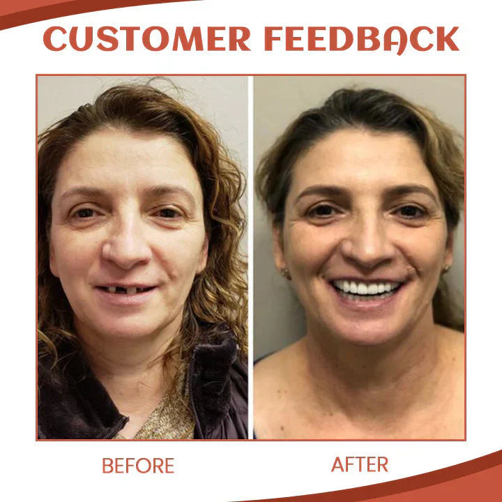 Silicone Denture Set ~ Achieve a natural, confident smile instantly^